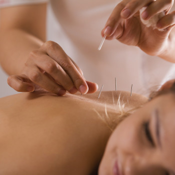 image Acupuncture