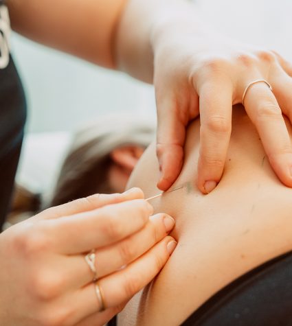 image Physiotherapy Dry Needle Puncture