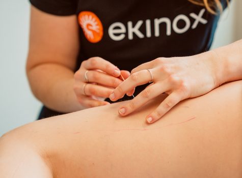 Physiothérapie avec aiguilles sèches : à quoi s’attendre?
